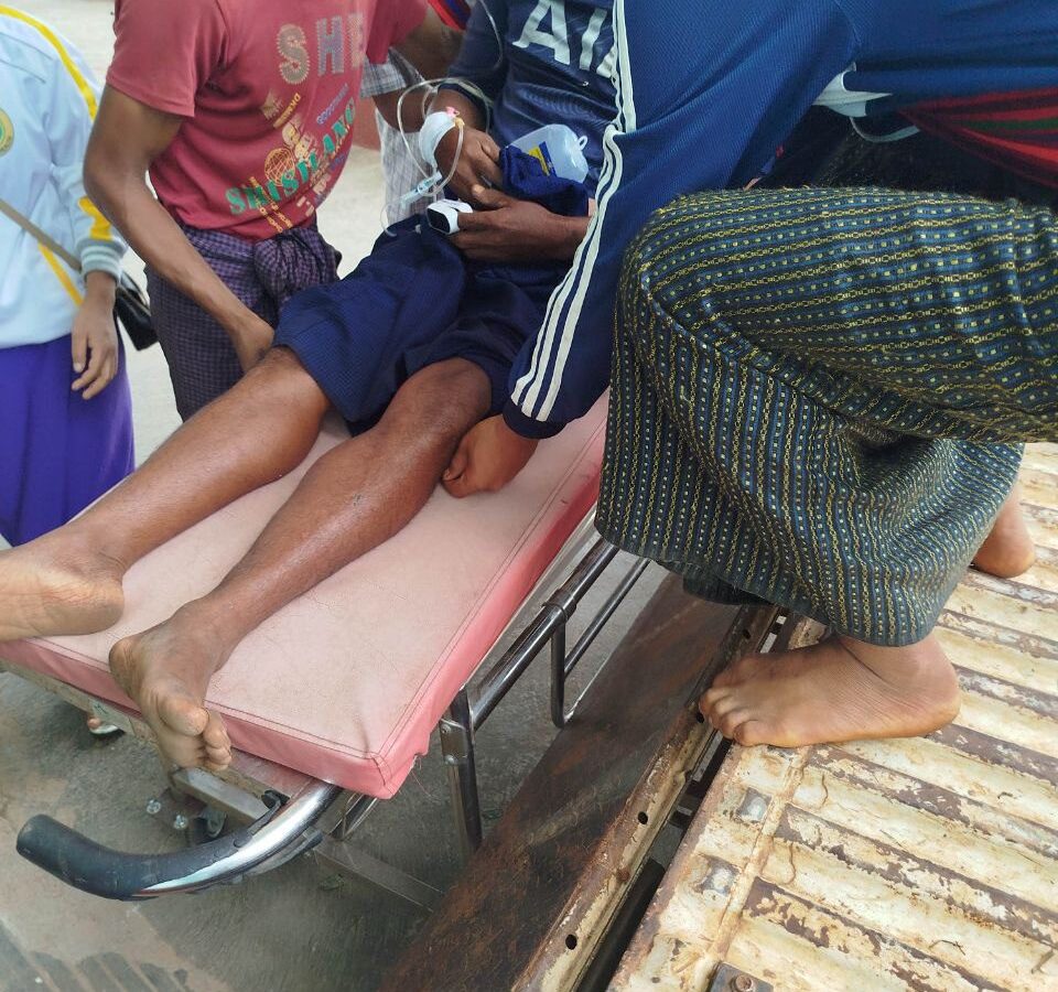 မြက်ရိတ်စဉ် အမျိုးသားတစ်ဦး ပိုးထိခံရ
