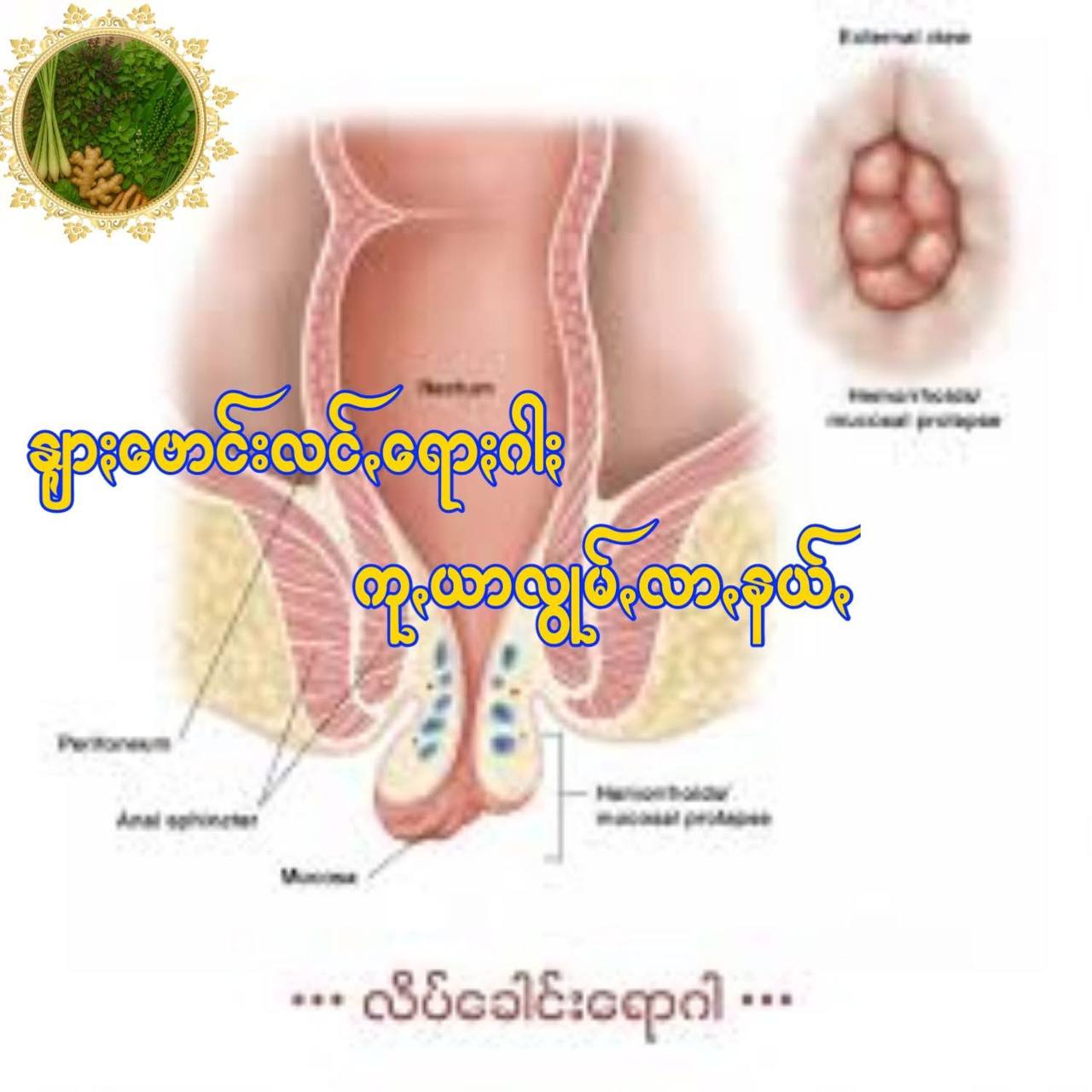 နျာႏဗောင်းလင်ꩻရောႏဂါႏ လွံႏလာꩻနယ်ꩻ